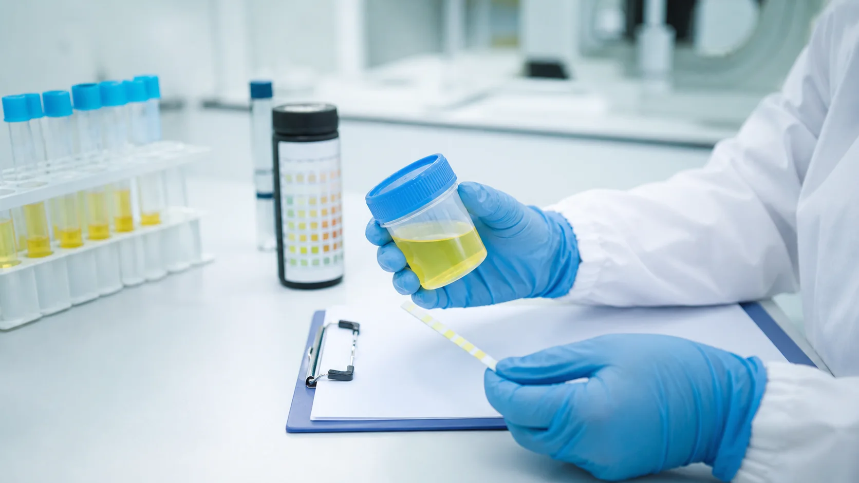 배뇨통 원인을 확인하기 위해 소변 검체와 시험지를 살펴보는 의료진